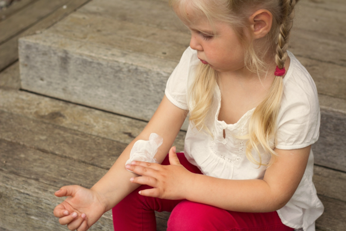 Eczema & Children: 6 Ways to Manage It Naturally